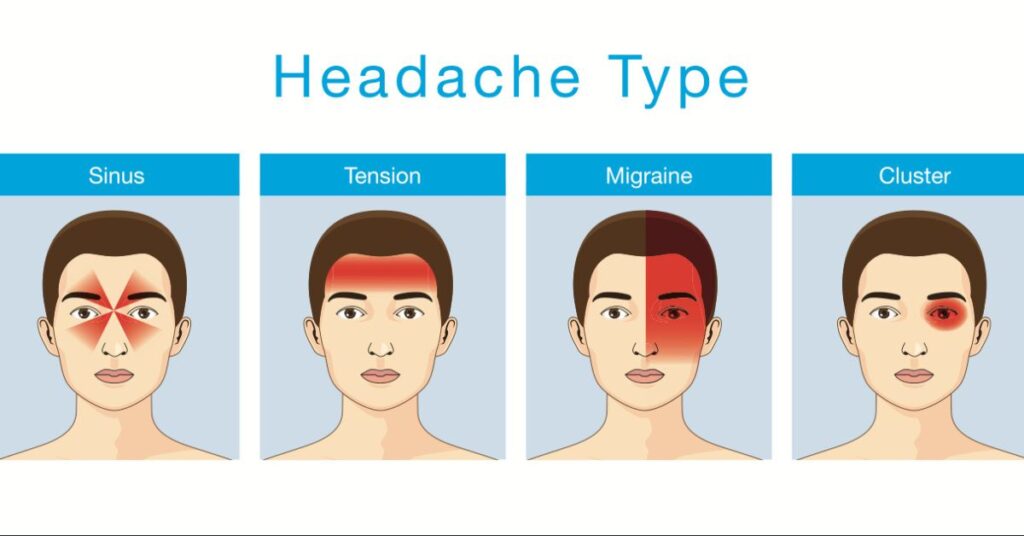 tension headache